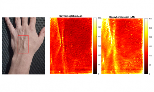 Os pesquisadores mapeiam a composição da pele e a concentração de hemoglobina oxigenada e desoxigenada. (Imagens: Infis/UFU)