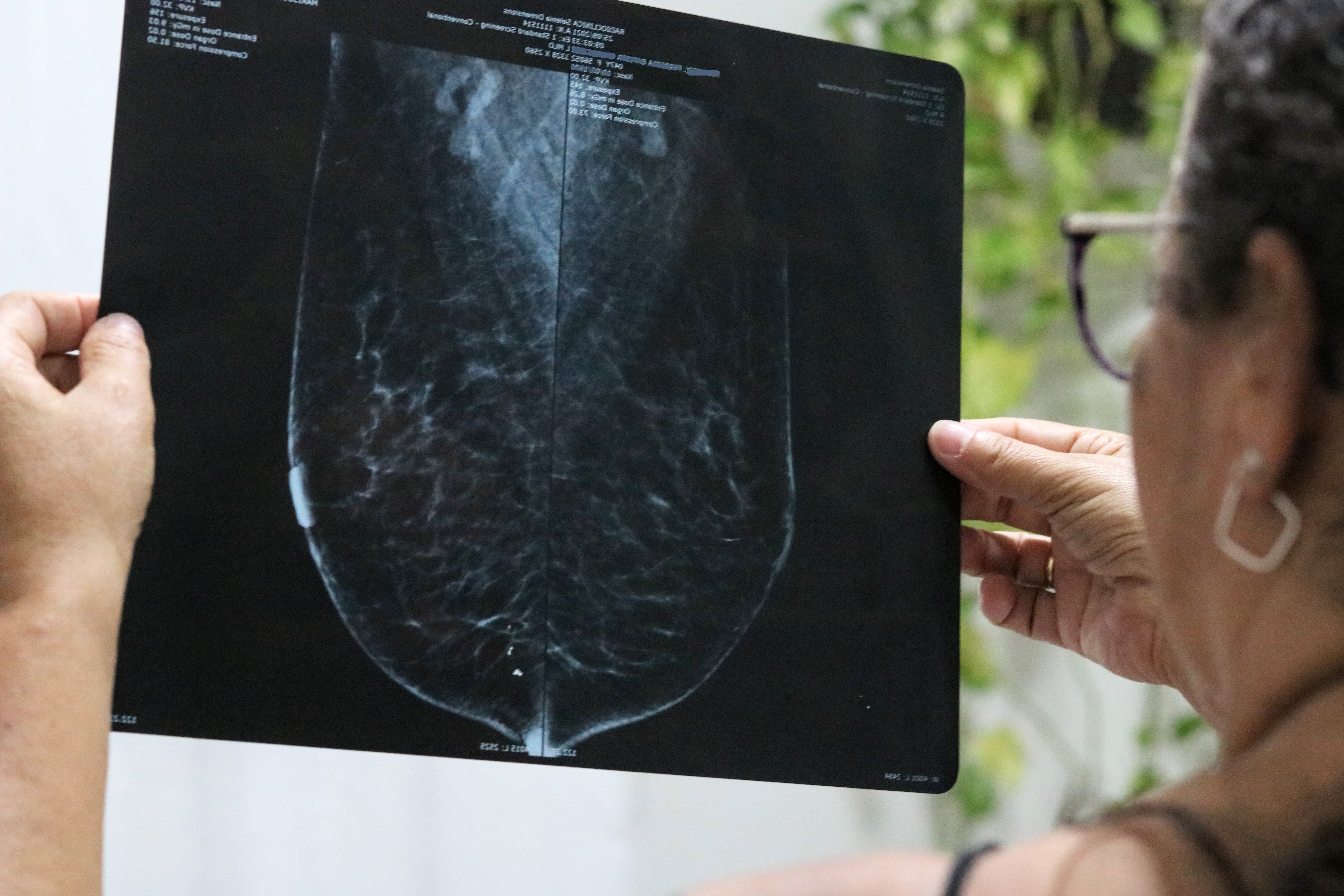 Mulher observa impressão de mamografia