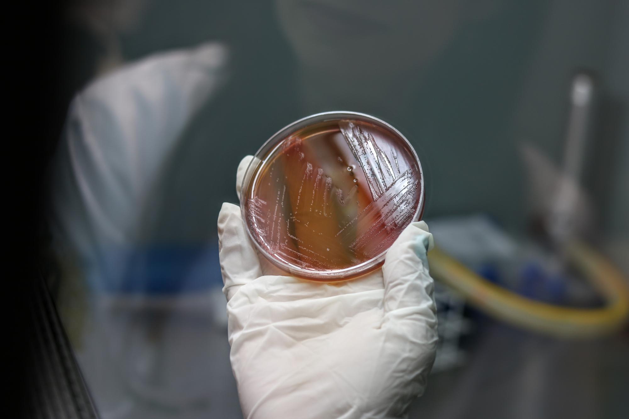 Imagem mostra placa de petri com uma colônia de bactérias