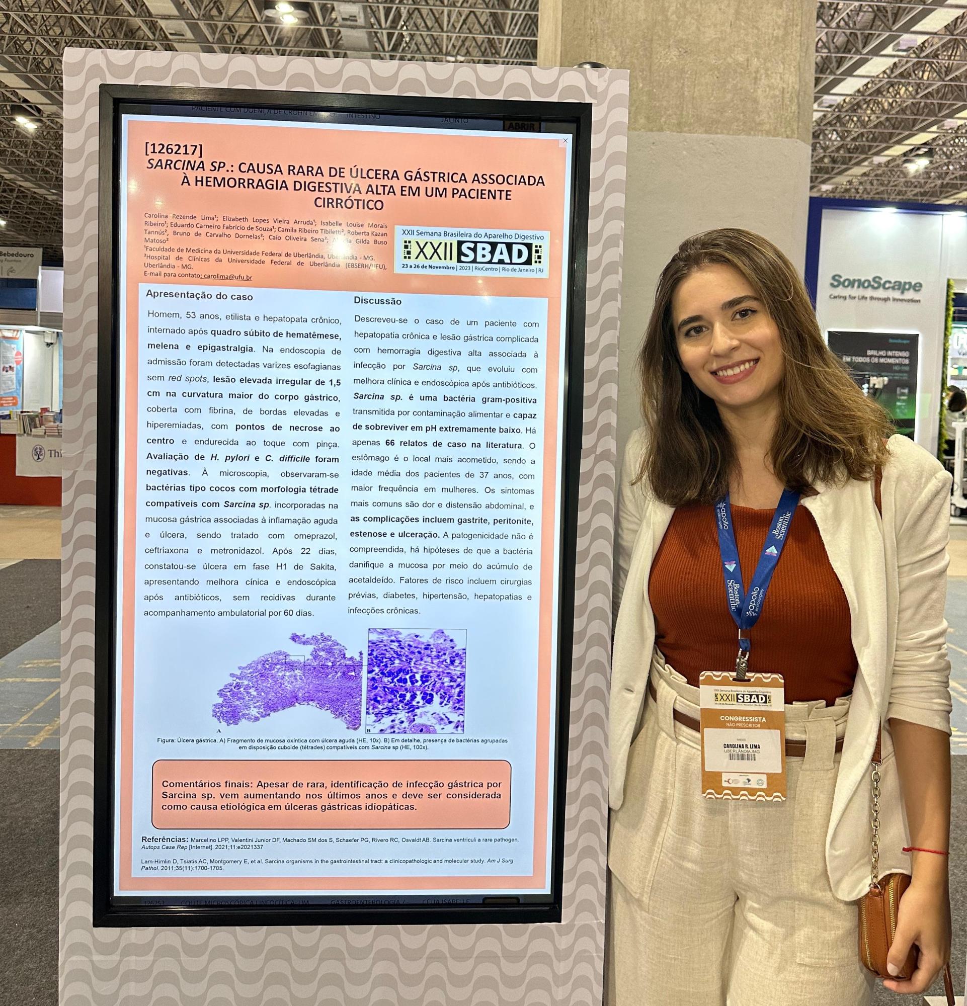 Carolina Lima apresentou o trabalho como autora principal e recebeu o prêmio de 2º lugar na categoria “Prêmio Ligas da Federação Brasileira de Gastroenterologia” (Foto: Arquivo pessoal)